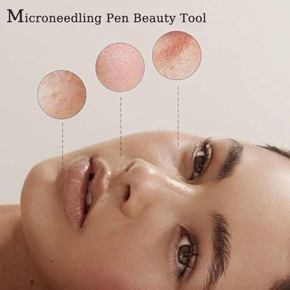 Derma Roller Pen 0,25 mm – Microneedling-Stift für Gesicht, Haare, Kopfhaut, Bart & Hautpflege zu Hause