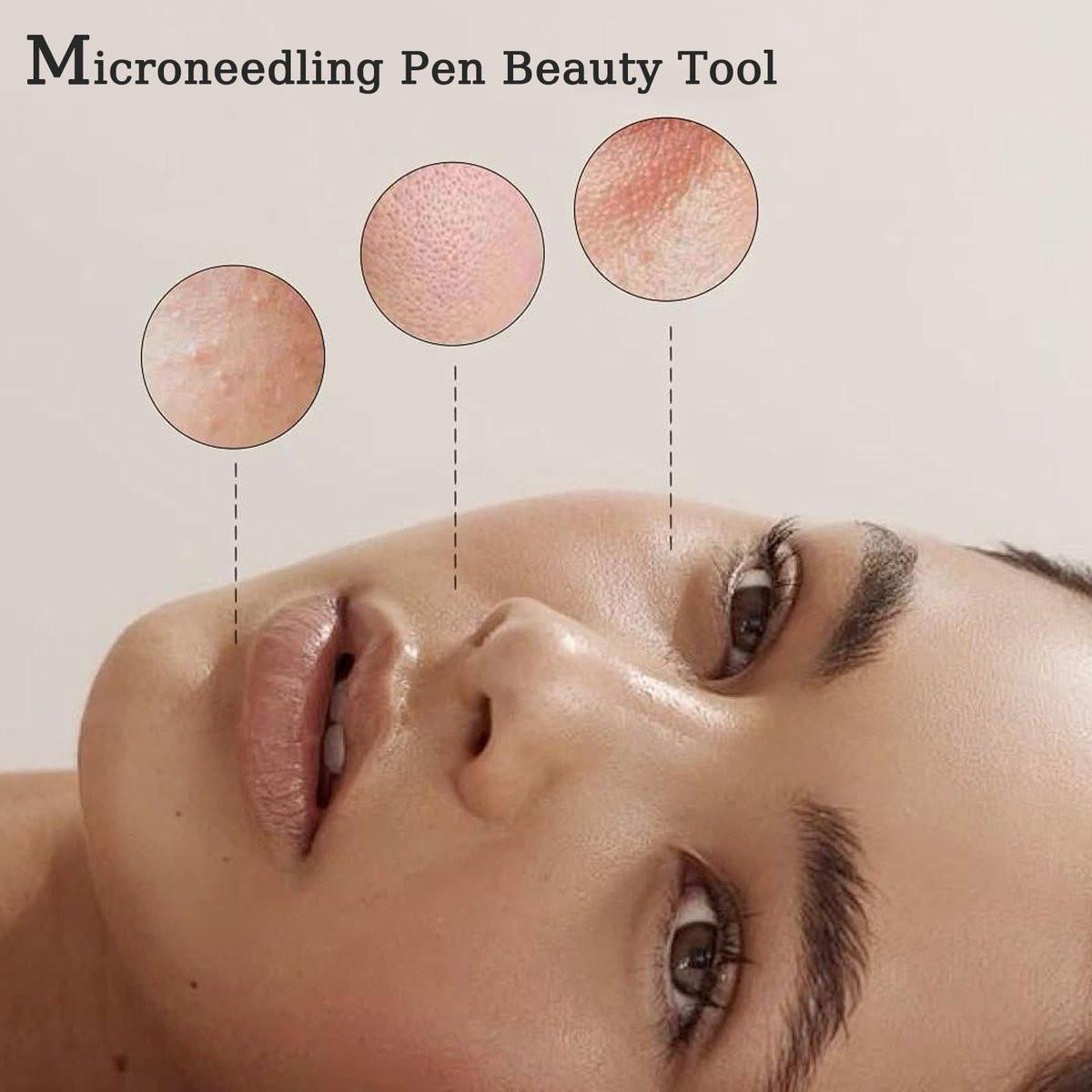 Derma Roller Pen 0,25 mm – Microneedling-Stift für Gesicht, Haare, Kopfhaut, Bart & Hautpflege zu Hause