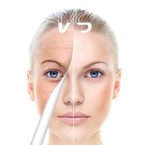 Derma Roller Pen 0,25 mm – Microneedling-Stift für Gesicht, Haare, Kopfhaut, Bart & Hautpflege zu Hause