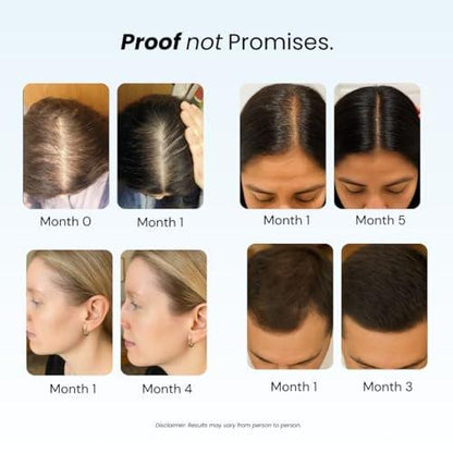 Growplex Revive Shampoo & Replenish Conditioner Bundle, Biotin Scalp Care System für Männer & Frauen, für voller und kräftiger aussehendes Haar täglich
