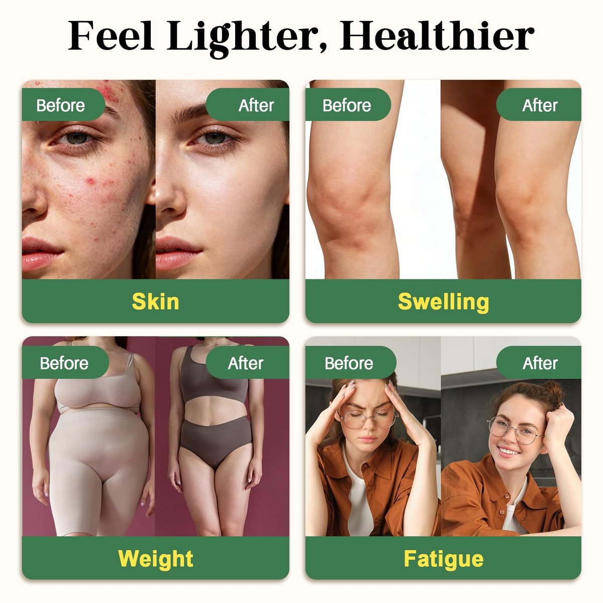 Migcopat 26-in-1 Liposomale Lymphdrainage-Tropfen – Echinacea, Kurkuma, Holunder, Löwenzahn, Vitamine und Königskerze für Lunge, Lymphsystem, Immununterstützung, Leberreinigung & -reparatur, 60 ml