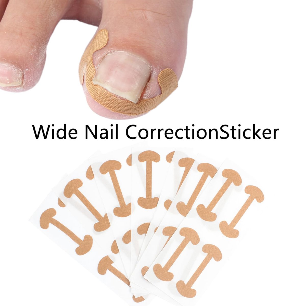 CHEMAILON Professionelles Nagelkorrektur-Set für eingewachsene Zehennägel – Edelstahl-Zehennagelzange, Korrekturpflaster, Heber & Werkzeuge zur Behandlung eingewachsener Zehennägel, Heim-Pediküre-Lösung