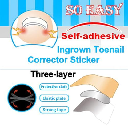 CHEMAILON Professionelles Nagelkorrektur-Set für eingewachsene Zehennägel – Edelstahl-Zehennagelzange, Korrekturpflaster, Heber & Werkzeuge zur Behandlung eingewachsener Zehennägel, Heim-Pediküre-Lösung