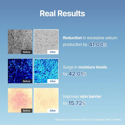 MEDITHERAPY Squalane Skin Booster Feuchtigkeitscreme – 8% Squalan + Panthenol + Hyaluronsäure | Hydratisierende Gesichtscreme für trockene empfindliche Haut | Leichte nicht fettende Barriere-Unterstützung 150 ml
