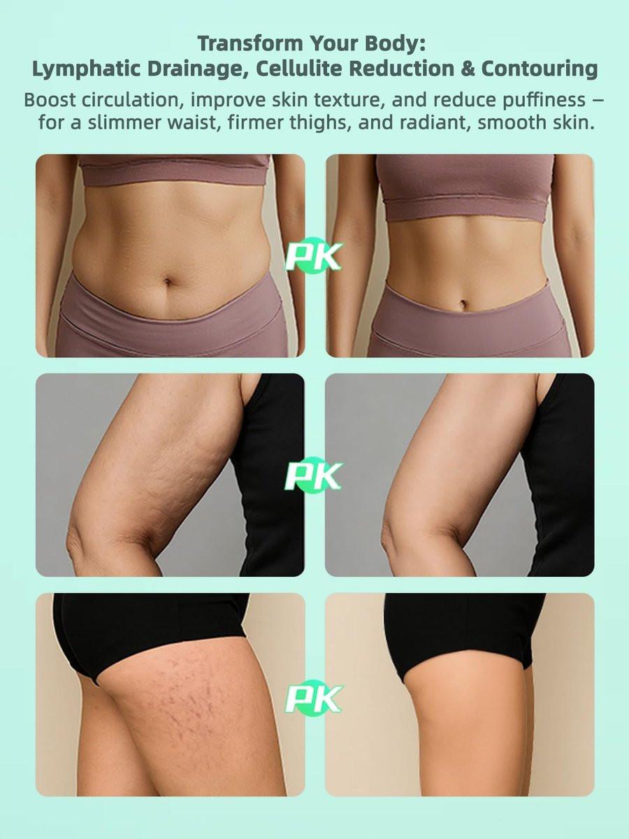 FEEJOY Elektrischer Lymphdrainage-Massager mit Pulstherapie & Wärme – 12-stufiges Schröpfmassagegerät zur Reduzierung von Cellulite, Körperformung, Tiefengewebs-Schmerzlinderung & Muskelregeneration, Weiß