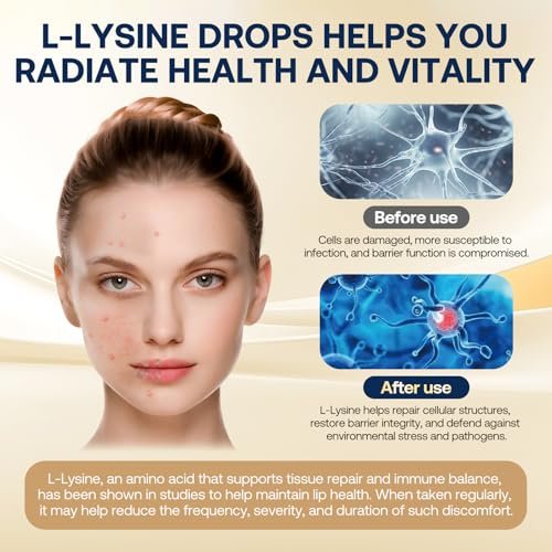 Liposomales L-Lysin 1000 mg flüssige Tropfen, 13-in-1 Lysin Monolaurin Komplex – Olivenblattextrakt mit Vitamin C, B6, D3, B12 & Zink für Kollagen, Lippen-, Haut- und Immununterstützung für Kinder & Erwachsene, 59 ml