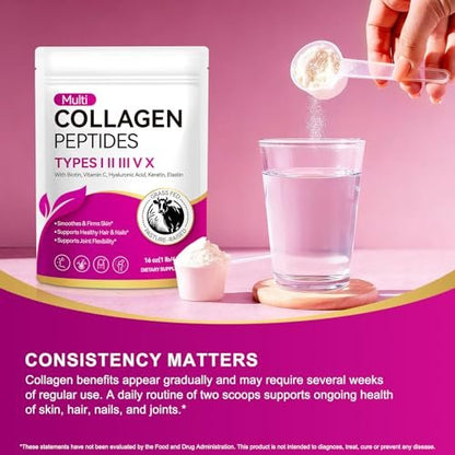 AEBEFBAW Multi-Kollagen-Peptid-Pulver | Typen I, II, III, V, X | 16 oz (41 Portionen) Hydrolysierte Kollagenpeptide | Unterstützt gesunde Haut, Gelenke, Haare und Nägel | Ungesüßt und löst sich leicht auf