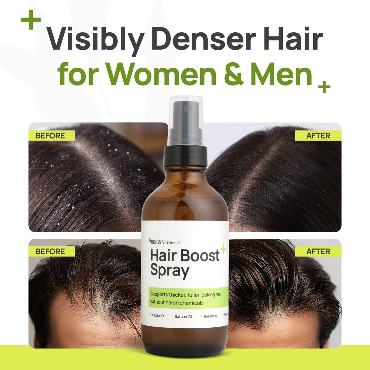 Brigs Naturals Haarspray für dichteres Haar und gesunde Kopfhaut – Hergestellt in den USA mit Bio-Botanicals, Rosmarinwasser, Pfefferminze, Biotin, Batana-Öl, Koffein und Pflegewirkstoffen