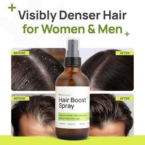 Brigs Naturals Haarspray für dichteres Haar und gesunde Kopfhaut – Hergestellt in den USA mit Bio-Botanicals, Rosmarinwasser, Pfefferminze, Biotin, Batana-Öl, Koffein und Pflegewirkstoffen