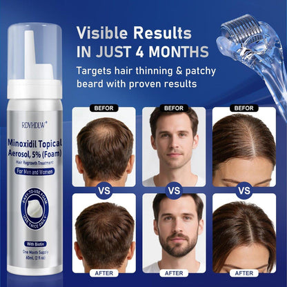 5% Minoxidil Schaum für Männer und Frauen Haarwuchs, Minoxidil Schaum für Haare und Bart, Haarwuchsbehandlung hilft bei Haarausfall und dünner werdendem Haar (7 Stück, 14,77 Unzen, 7 Monate Vorrat)
