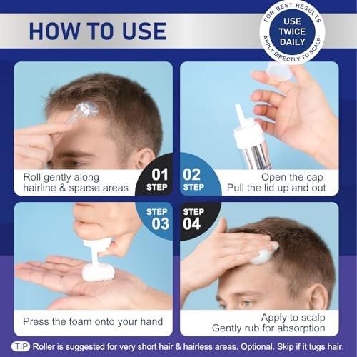 5% Minoxidil Schaum für Männer und Frauen Haarwuchs, Minoxidil Schaum für Haare und Bart, Haarwuchsbehandlung hilft bei Haarausfall und dünner werdendem Haar (7 Stück, 14,77 Unzen, 7 Monate Vorrat)