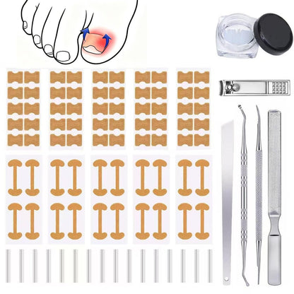 GEMSANVA Eingewachsener Zehennagel Korrektur-Set mit Korrekturstreifen, Professionelles Werkzeug-Set für eingewachsene Zehennägel, Kurven-Korrekturpflaster für die häusliche Pediküre-Pflege