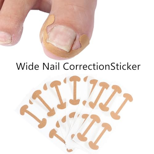 GEMSANVA Eingewachsener Zehennagel Korrektur-Set mit Korrekturstreifen, Professionelles Werkzeug-Set für eingewachsene Zehennägel, Kurven-Korrekturpflaster für die häusliche Pediküre-Pflege