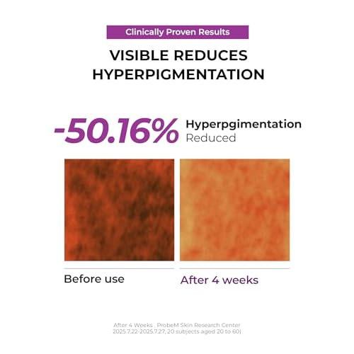 JUMISO Niacinamide 5+ Overnight Capsule Cream – 50ml Schmelzende Kapsel-Schlafmaske mit 5% Niacinamid, 1% TXA & Glutathion für Glas-Haut, Koreanische Hautpflege