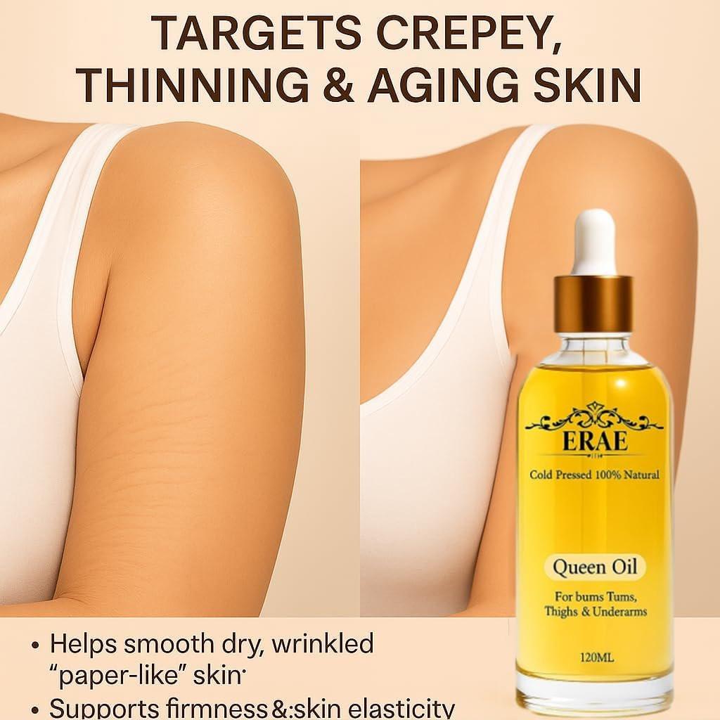 ERAE Queen Body Oil – Kaltgepresste botanische Mischung für hydratisierte & straff aussehende Haut, leichtes, schnell einziehendes Körperöl für Arme, Beine & Bauch