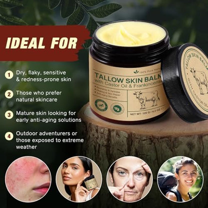 ZIXAOK 100% Grass-Fed Tallow, Organic Castor & Frankincense Oil Face Balm - Anti-Aging Feuchtigkeitscreme für empfindliche & trockene Haut, repariert die Hautbarriere, handgefertigt für Gesicht & Körper, 4,2 oz