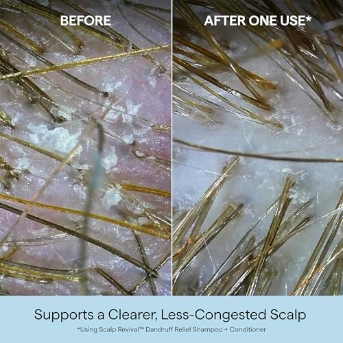 Briogeo Scalp Revival Anti-Schuppen Conditioner mit Aktivkohle & Salicylsäure 1,8% – Beruhigende Pflege für schuppige, juckende Kopfhaut, farbsicher, vegan & tierversuchsfrei, 250 ml