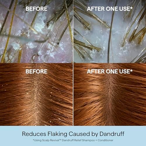 Briogeo Scalp Revival Anti-Schuppen Conditioner mit Aktivkohle & Salicylsäure 1,8% – Beruhigende Pflege für schuppige, juckende Kopfhaut, farbsicher, vegan & tierversuchsfrei, 250 ml