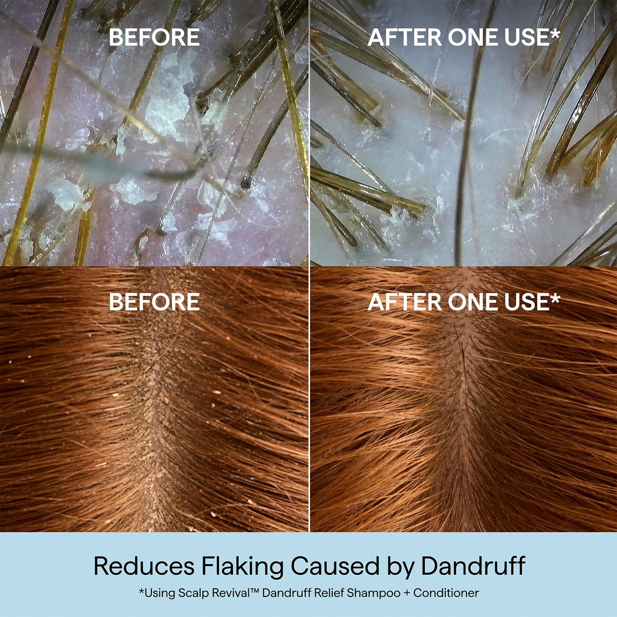 Briogeo Scalp Revival Anti-Schuppen Conditioner mit Aktivkohle & Salicylsäure 1,8% – Beruhigende Pflege für schuppige, juckende Kopfhaut, farbsicher, vegan & tierversuchsfrei, 250 ml