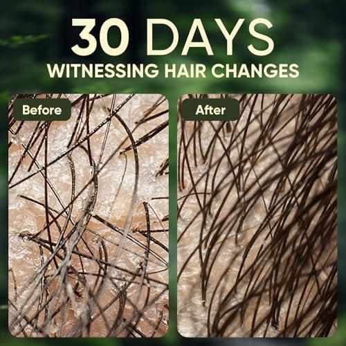 Batana Oil Shampoo und Conditioner Set – Haarpflege für Haarausfall, Vitalität und Wachstum, repariert Schäden, für Männer & Frauen, 300ml+300ml (10,58 fl.oz)