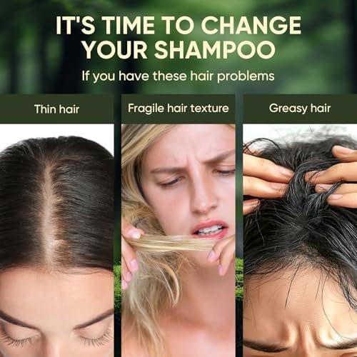 Batana Oil Shampoo und Conditioner Set – Haarpflege für Haarausfall, Vitalität und Wachstum, repariert Schäden, für Männer & Frauen, 300ml+300ml (10,58 fl.oz)