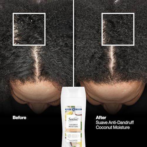 Suave Anti-Schuppen Shampoo für Frauen, Kokosnuss-Feuchtigkeit, 1% Pyrithion-Zink Schuppenbehandlung, kontrolliert Flocken, Juckreiz & trockene Kopfhaut, 6er-Pack, 12,6 FL OZ
