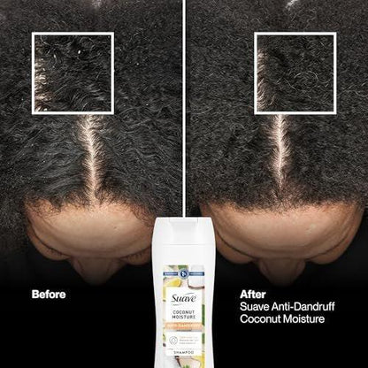 Suave Anti-Schuppen Shampoo für Frauen, Kokosnuss-Feuchtigkeit, 1% Pyrithion-Zink Schuppenbehandlung, kontrolliert Flocken, Juckreiz & trockene Kopfhaut, 6er-Pack, 12,6 FL OZ