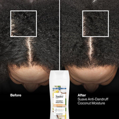 Suave Anti-Schuppen Shampoo für Frauen, Kokosnuss-Feuchtigkeit, 1% Pyrithion-Zink Schuppenbehandlung, kontrolliert Flocken, Juckreiz & trockene Kopfhaut, 6er-Pack, 12,6 FL OZ