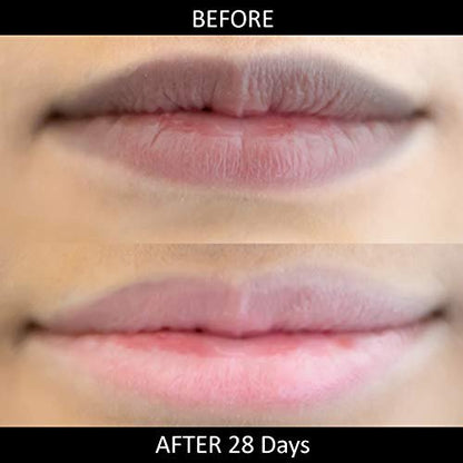 Lip Lightening Stick für dunkle Lippen von Omorfee | Lippenbalsam für trockene Lippen, Raucher & Nichtraucher | Reduziert Verfärbungen | Natürlicher Schutz & Reparatur – 6g / 0,21 oz