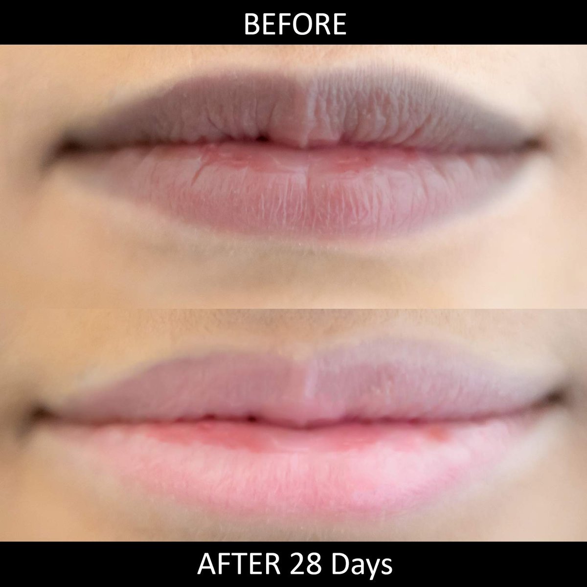 Lip Lightening Stick für dunkle Lippen von Omorfee | Lippenbalsam für trockene Lippen, Raucher & Nichtraucher | Reduziert Verfärbungen | Natürlicher Schutz & Reparatur – 6g / 0,21 oz