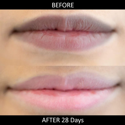 Lip Lightening Stick für dunkle Lippen von Omorfee | Lippenbalsam für trockene Lippen, Raucher & Nichtraucher | Reduziert Verfärbungen | Natürlicher Schutz & Reparatur – 6g / 0,21 oz