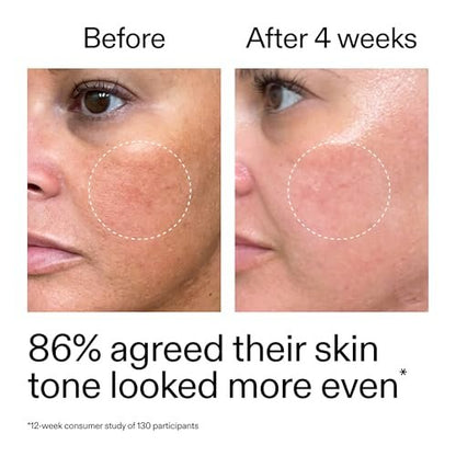 The INKEY List Starter Dual Retinol Serum – 0,5% Amisol Trio & 0,2% Symrelief, 30 ml – Sanfte Hauterneuerung, glättet feine Linien, Feuchtigkeit & Barriereschutz – Geeignet für empfindliche Haut