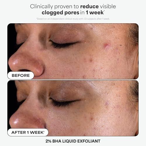 Paula's Choice Favorites Mini Kit – 4-teiliges Hautpflege-Set mit BHA, Retinol, Azelainsäure & SPF 50 für strahlende Haut – Reisegröße