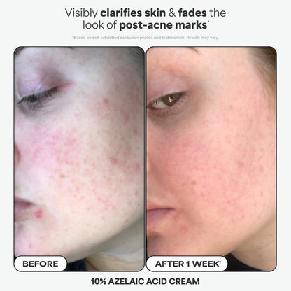 Paula's Choice Favorites Mini Kit – 4-teiliges Hautpflege-Set mit BHA, Retinol, Azelainsäure & SPF 50 für strahlende Haut – Reisegröße