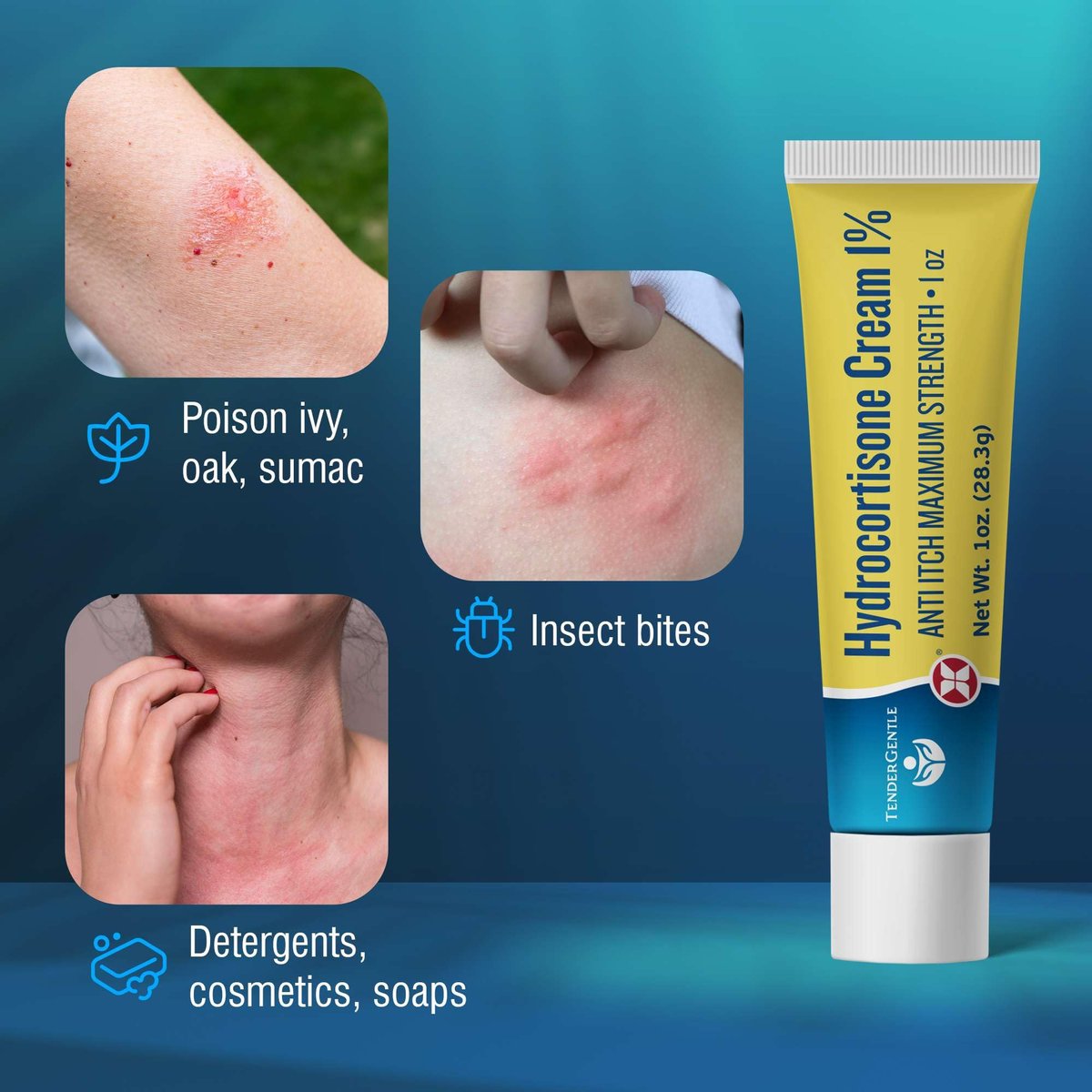 TenderGentle 1% Hydrocortison Creme Maximalstärke - 28 g Anti-Juckreiz Creme bei Juckreiz und Hautausschlägen - für Ekzeme, Giftefeu, Insektenstiche und mehr