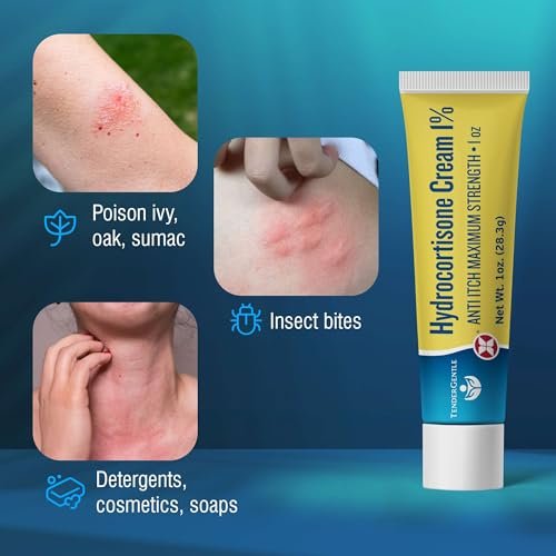 TenderGentle 1% Hydrocortison Creme Maximalstärke - 28 g Anti-Juckreiz Creme bei Juckreiz und Hautausschlägen - für Ekzeme, Giftefeu, Insektenstiche und mehr