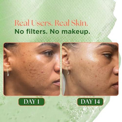 VELVENTE Matcha Toner Pads (100 Stück) mit Rose PDRN, Peptiden & Hyaluronsäure | Koreanische Gesichtspads für dunkle Flecken, zu Akne neigende & ungleichmäßige Haut, beruhigende, strahlende Haut, Make-up-Vorbereitung, tägliche Hautpflege