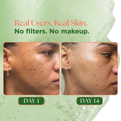 VELVENTE Matcha Toner Pads (100 Stück) mit Rose PDRN, Peptiden & Hyaluronsäure | Koreanische Gesichtspads für dunkle Flecken, zu Akne neigende & ungleichmäßige Haut, beruhigende, strahlende Haut, Make-up-Vorbereitung, tägliche Hautpflege