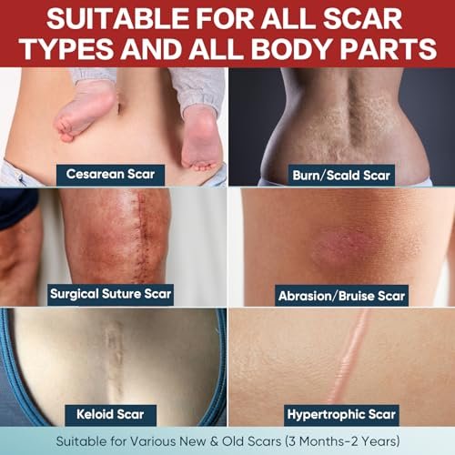 Silicone Scar Tape 1,6" x 60" Rolle - Wiederverwendbare Silikon-Narbenpflaster für Operationsnarben, Kaiserschnitt, Bauchdeckenstraffung, Keloidnarben - Leicht zuschneidbar