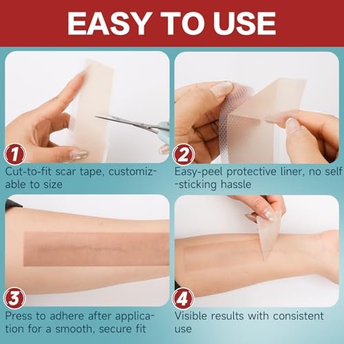 Silicone Scar Tape 1,6" x 60" Rolle - Wiederverwendbare Silikon-Narbenpflaster für Operationsnarben, Kaiserschnitt, Bauchdeckenstraffung, Keloidnarben - Leicht zuschneidbar