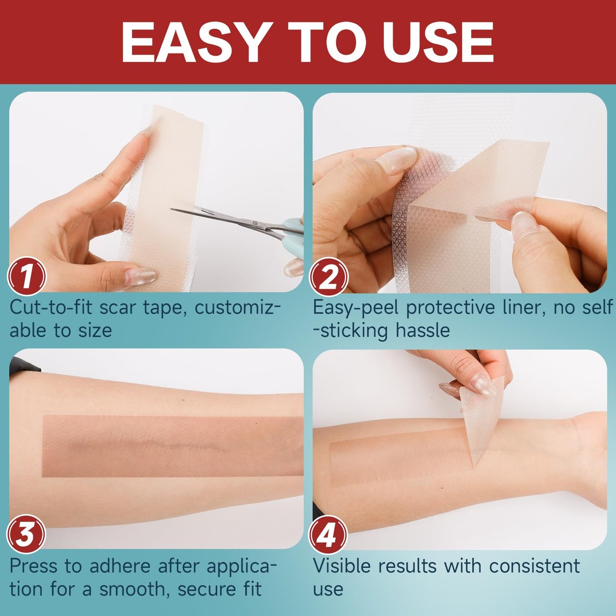 Silicone Scar Tape 1,6" x 60" Rolle - Wiederverwendbare Silikon-Narbenpflaster für Operationsnarben, Kaiserschnitt, Bauchdeckenstraffung, Keloidnarben - Leicht zuschneidbar