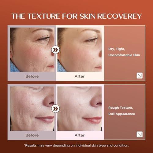 Vigority Weihrauch Balsam: Restorative Feuchtigkeitscreme für trockene, reife & rissige Haut – Glättet alternde Haut mit Helichrysum & Bakuchiol – Hydratisiert, pflegt & revitalisiert für Gesicht & Körper – 100 ml