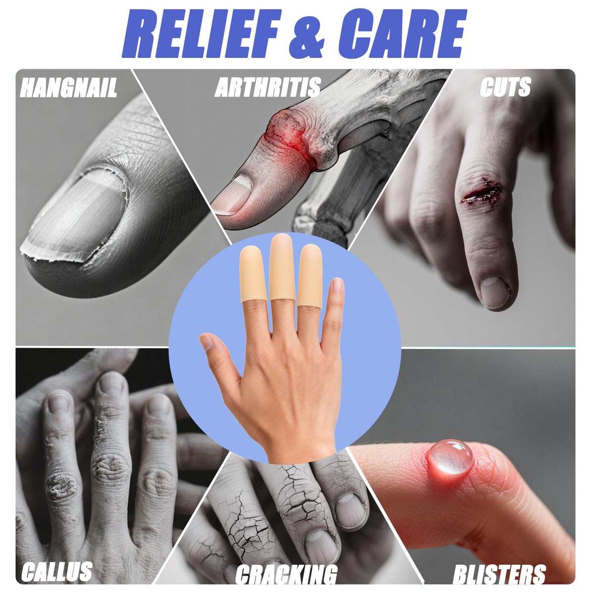 Gel-Fingerlinge Silikon – Schutzkappen für Finger und Daumen bei Arthritis, Rissen, Blasen, Hornhaut und Nagelhaut – Schmerzlinderung & Schutz (Nude)