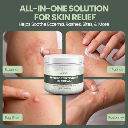 ProHeal 1% Hydrocortison Creme Maximum Stärke mit Aloe Vera - 113g Anti-Juckreiz Creme bei Insektenstichen, Ekzemen, Giftefeu, Gifteiche, Giftsumach und mehr