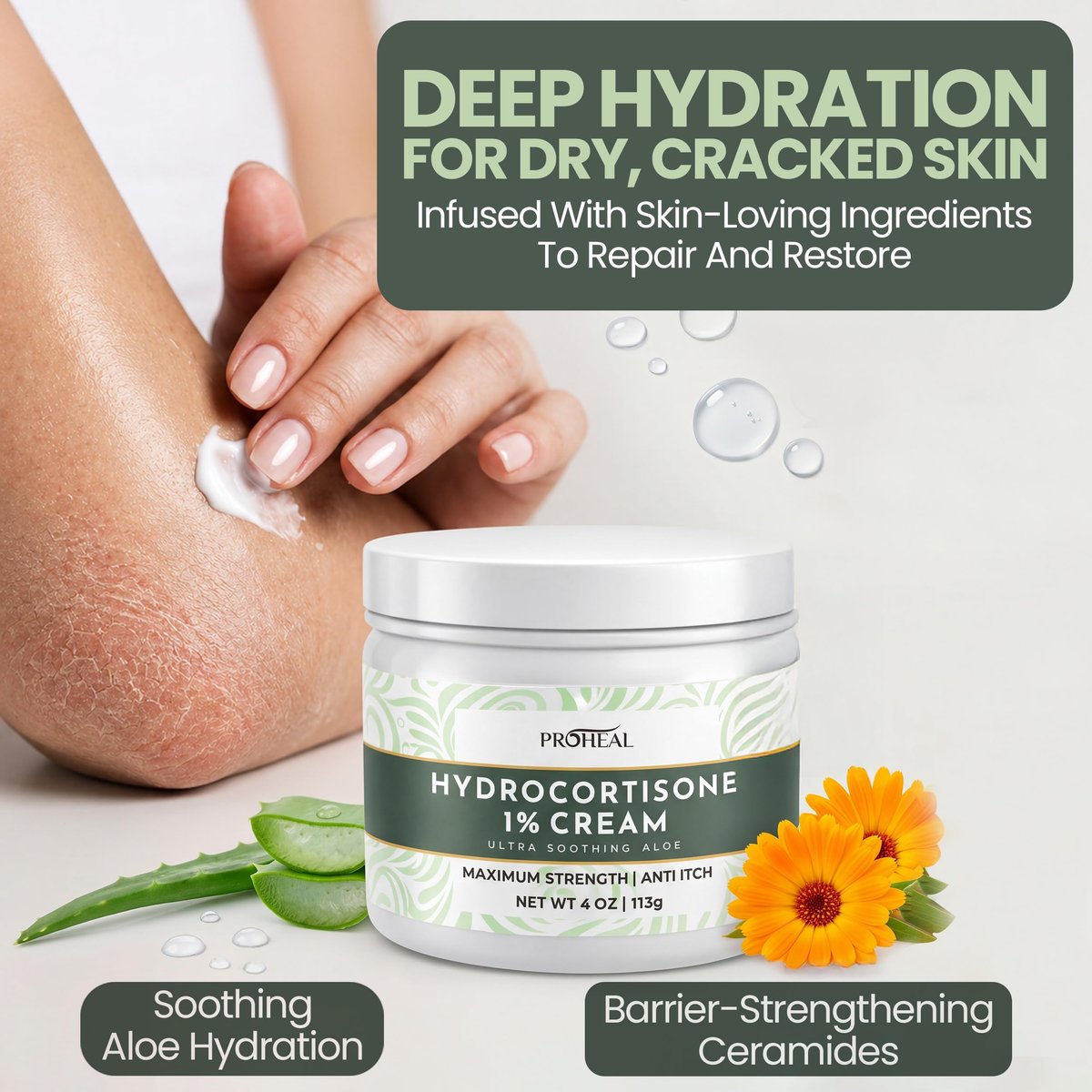 ProHeal 1% Hydrocortison Creme Maximum Stärke mit Aloe Vera - 113g Anti-Juckreiz Creme bei Insektenstichen, Ekzemen, Giftefeu, Gifteiche, Giftsumach und mehr