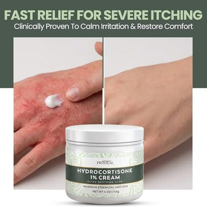 ProHeal 1% Hydrocortison Creme Maximum Stärke mit Aloe Vera - 113g Anti-Juckreiz Creme bei Insektenstichen, Ekzemen, Giftefeu, Gifteiche, Giftsumach und mehr