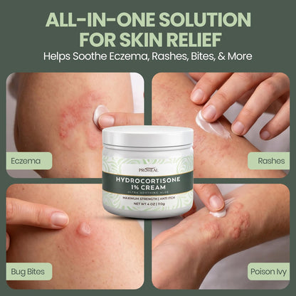 ProHeal 1% Hydrocortison Creme Maximum Stärke mit Aloe Vera - 113g Anti-Juckreiz Creme bei Insektenstichen, Ekzemen, Giftefeu, Gifteiche, Giftsumach und mehr