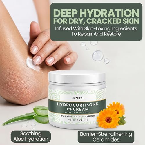 ProHeal 1% Hydrocortison Creme Maximum Stärke mit Aloe Vera - 113g Anti-Juckreiz Creme bei Insektenstichen, Ekzemen, Giftefeu, Gifteiche, Giftsumach und mehr