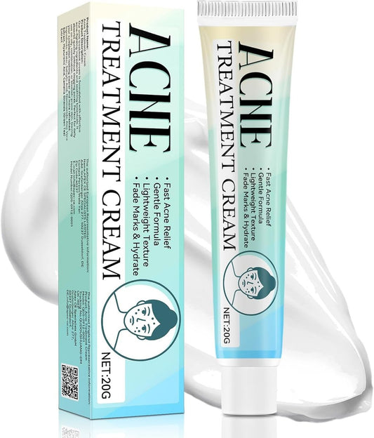 Akne-Behandlung für das Gesicht – Akne-Creme, Pickelcreme für alle Hauttypen, Hautpflegecreme für fettige & zu Unreinheiten neigende Haut, verbessert das Hautbild