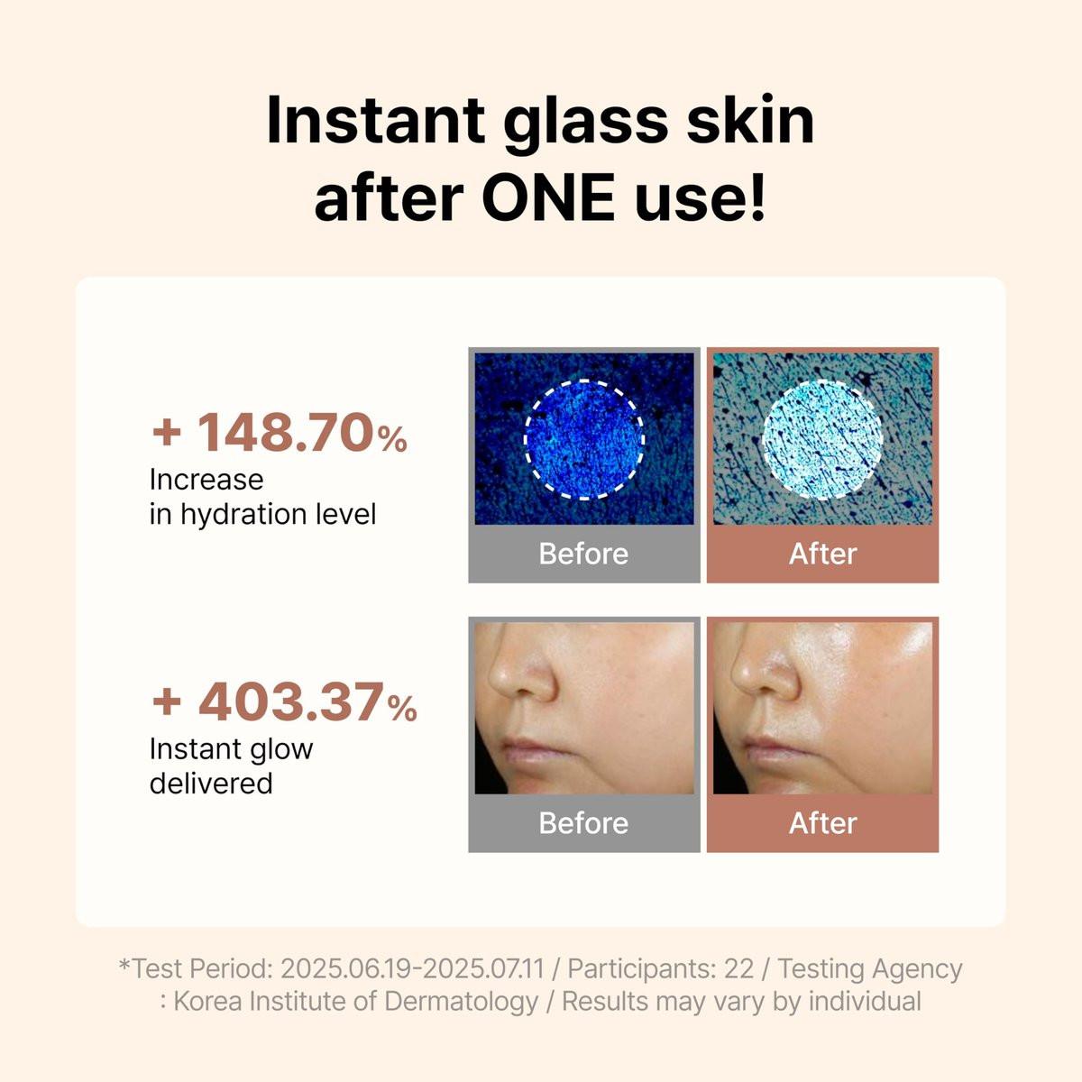 Siore NMN Fresh Bubble Toner – Glow-Boostender Toner mit 99% reinem NMN 10.000 ppm, Resveratrol, Centella, Niacinamid und Ceramid | Glasglanz-Haut | Koreanische Apotheken-Anti-Aging-Pflege